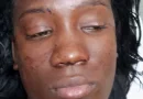 Mujer resulta herida tras violento ataque con botella durante riña