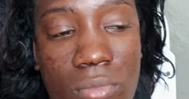 Mujer resulta herida tras violento ataque con botella durante riña